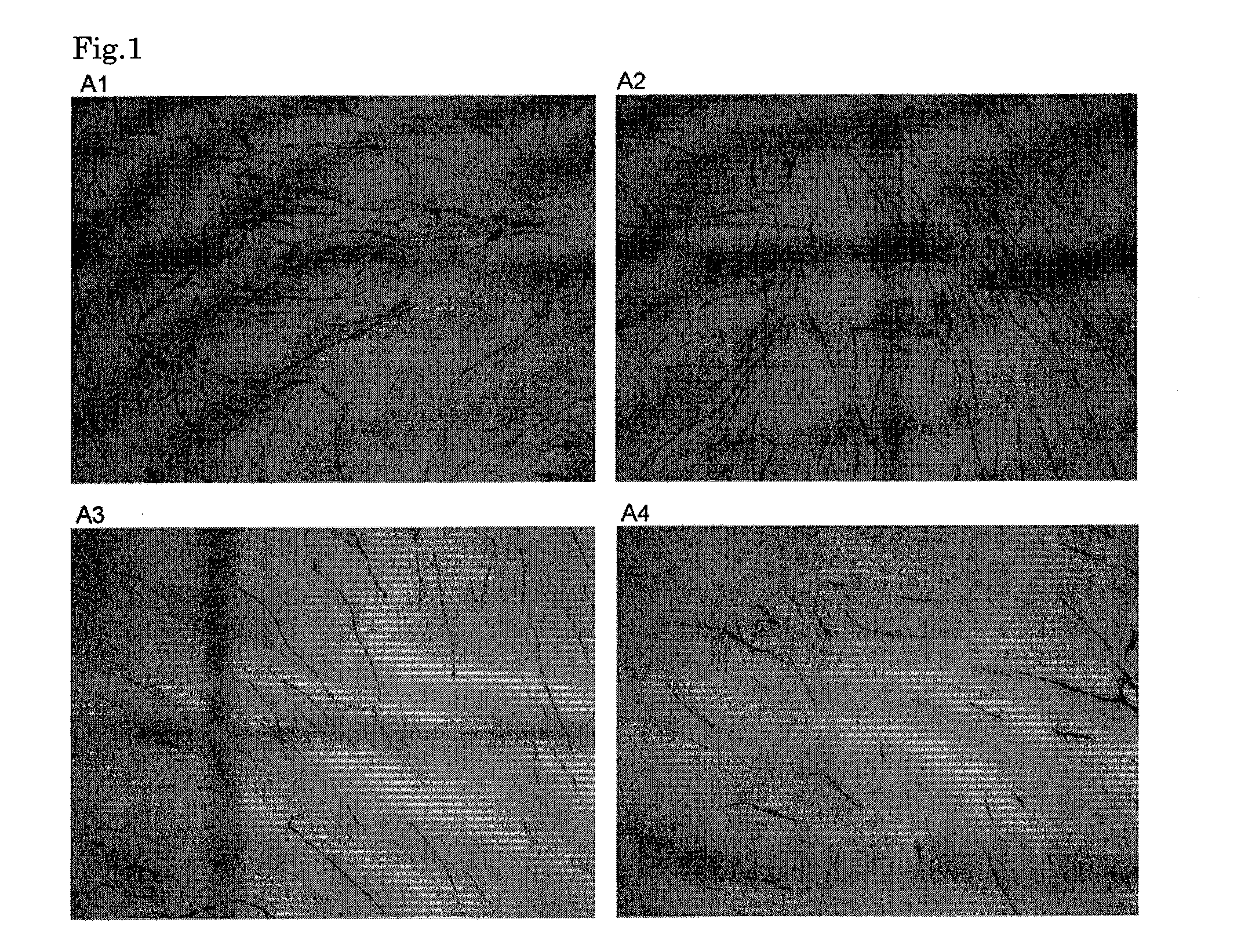 Anti-angiogenic composition comprising grain-derived component as active ingredient