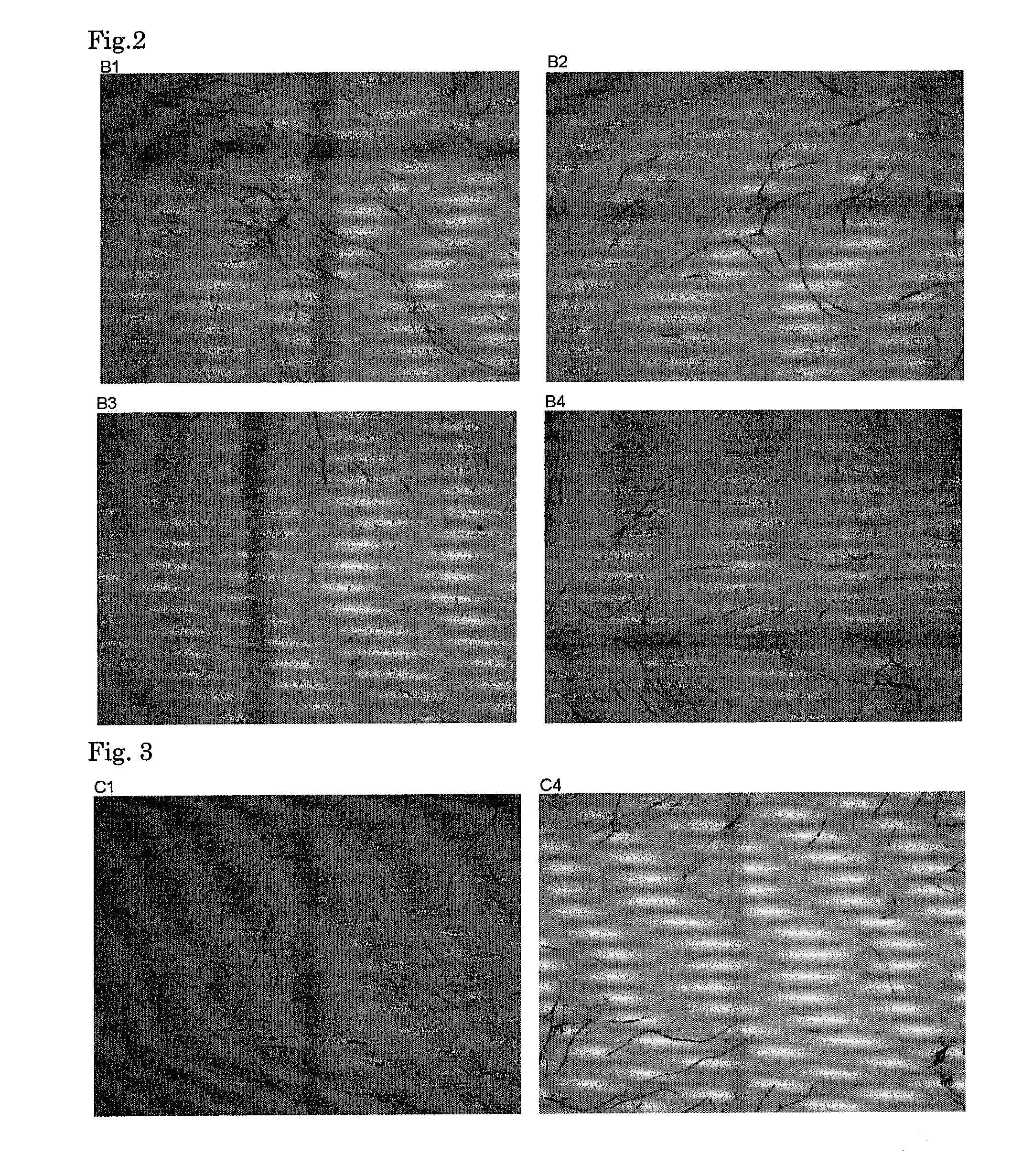 Anti-angiogenic composition comprising grain-derived component as active ingredient