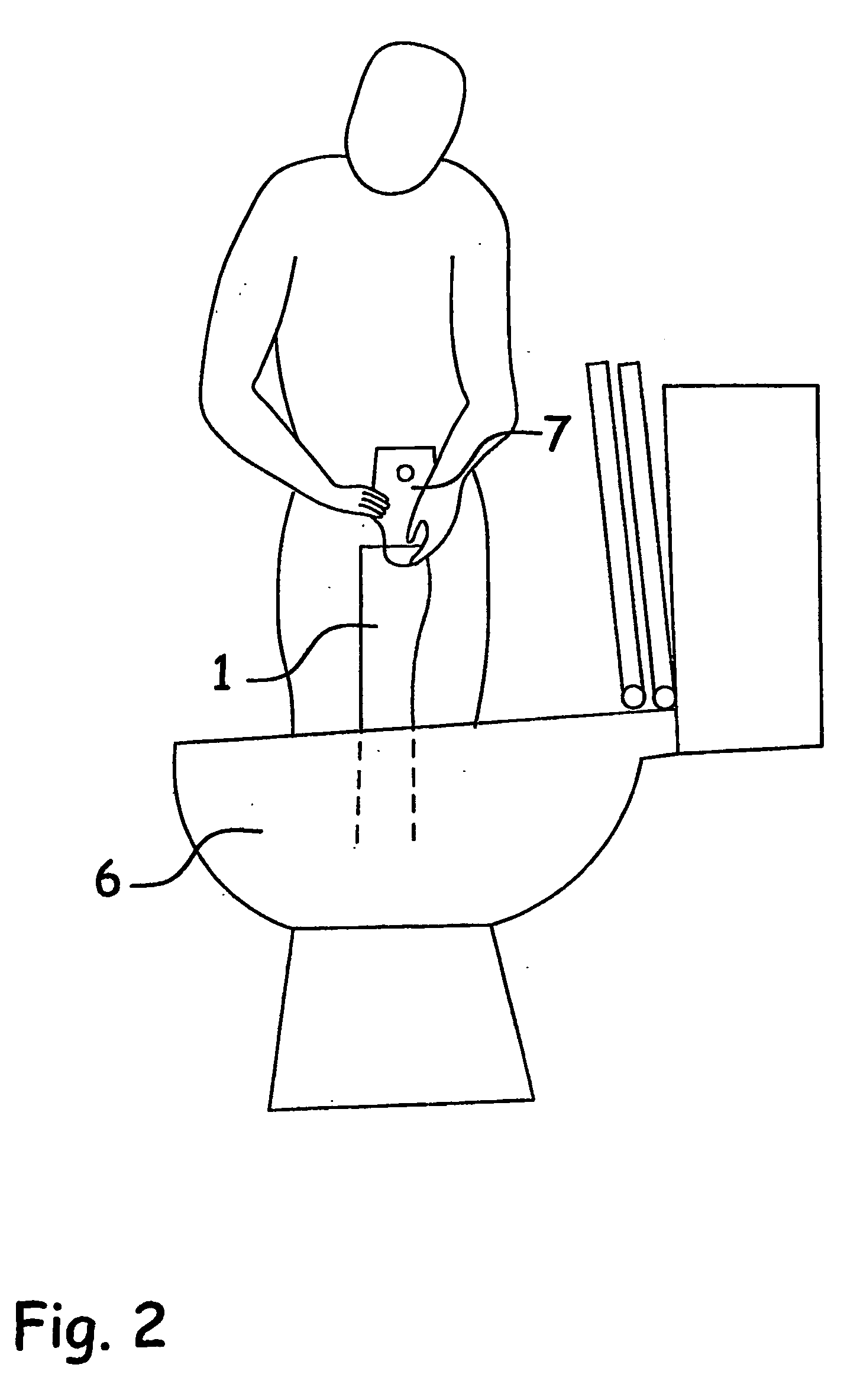 Disposable Ostomy Irrigation Sleeve