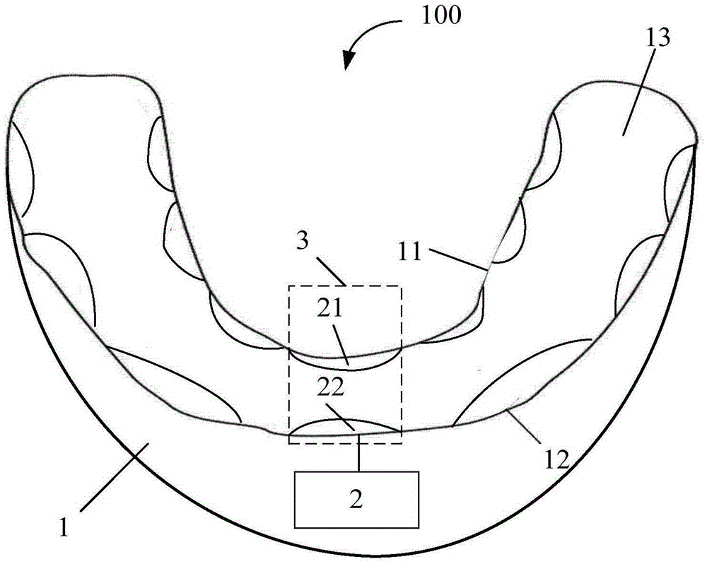 Automatic orthodontic apparatus and method