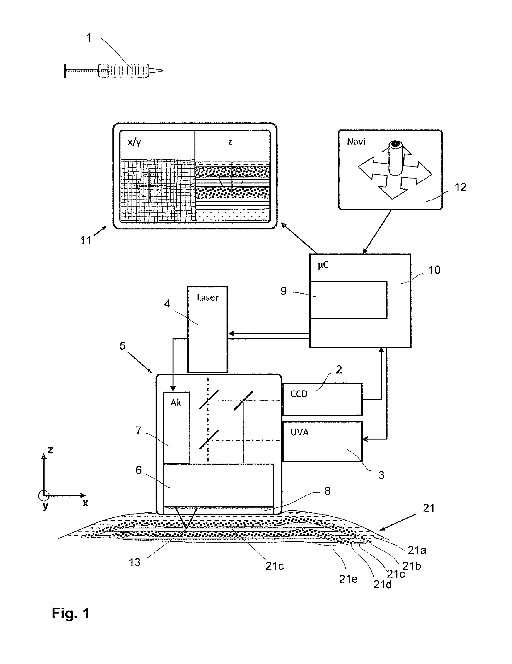 Laser therapy system for noninvasive correction of the refractive system of the eye