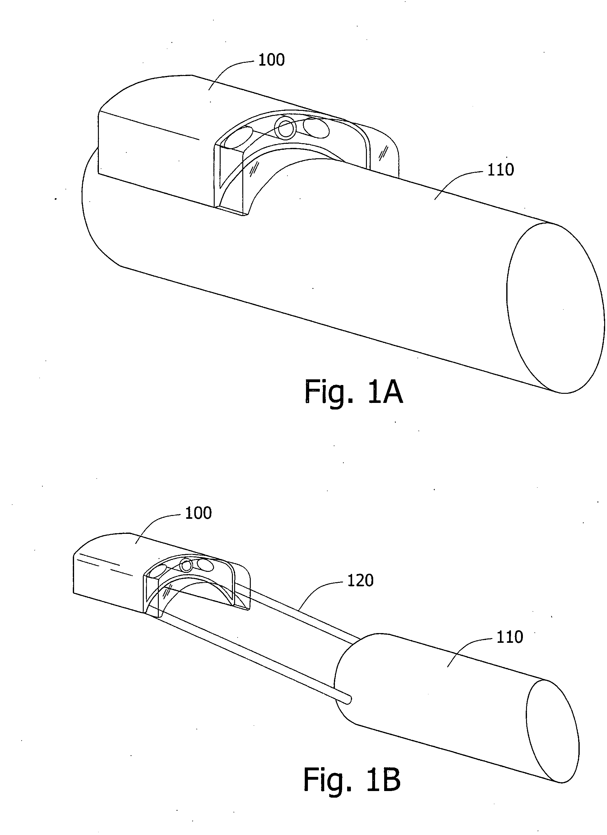 Device and method for viewing a body lumen