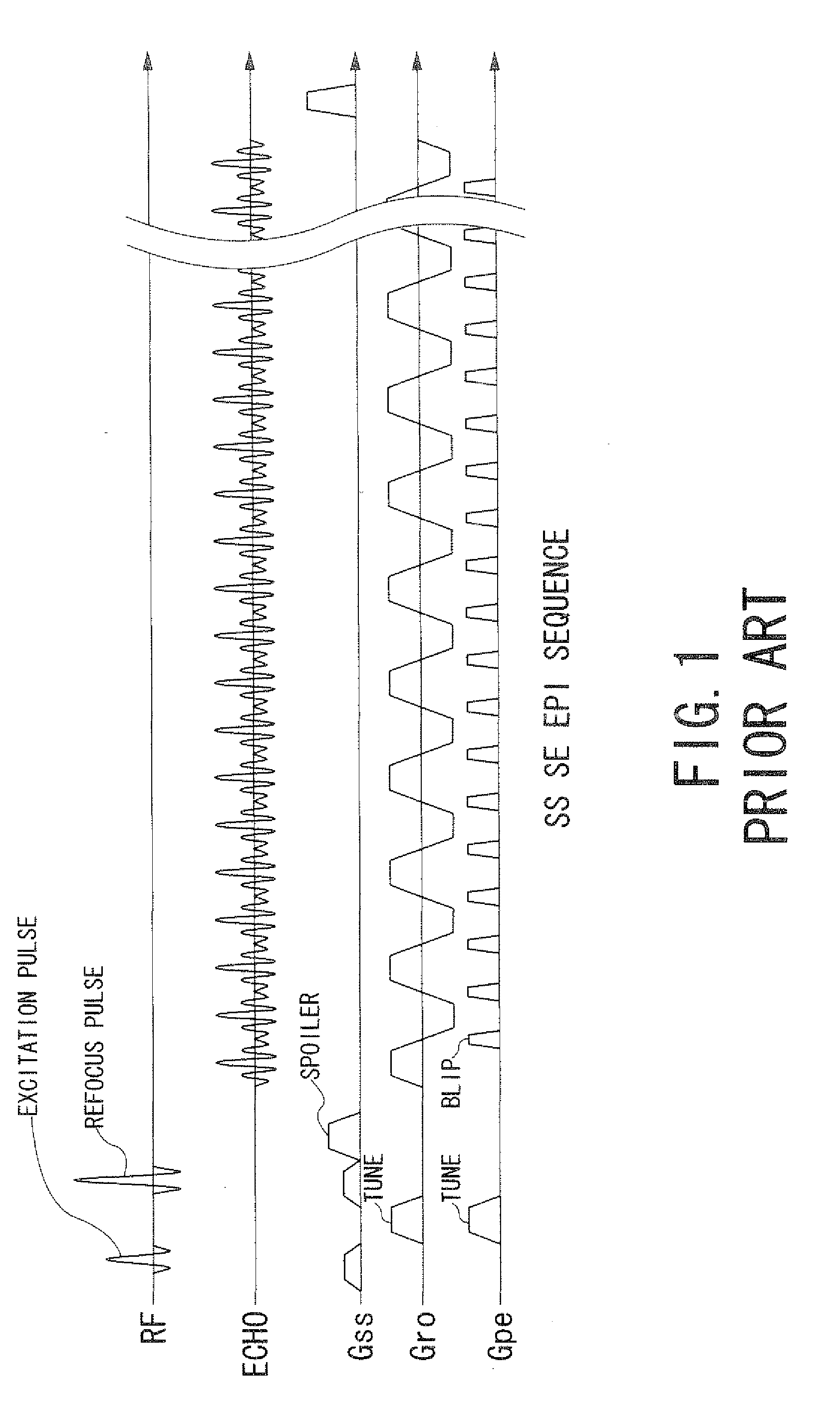 Magnetic resonance imaging apparatus and magnetic resonance imaging method