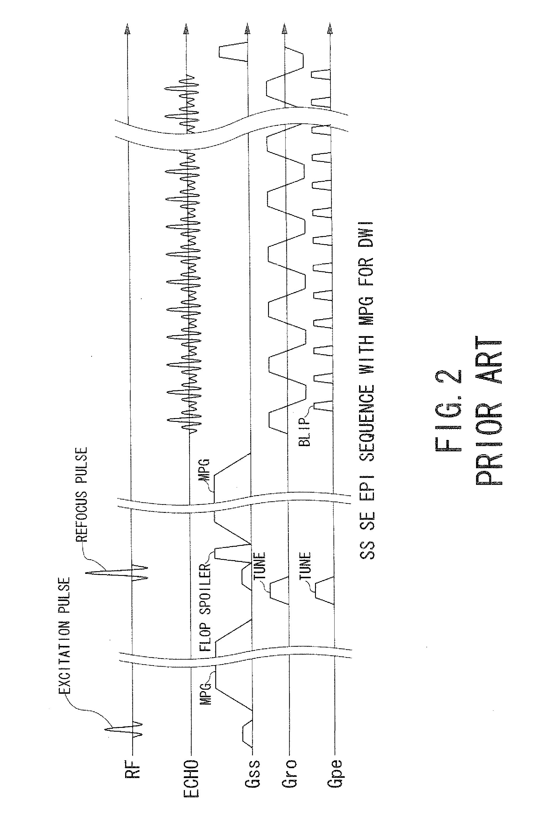 Magnetic resonance imaging apparatus and magnetic resonance imaging method