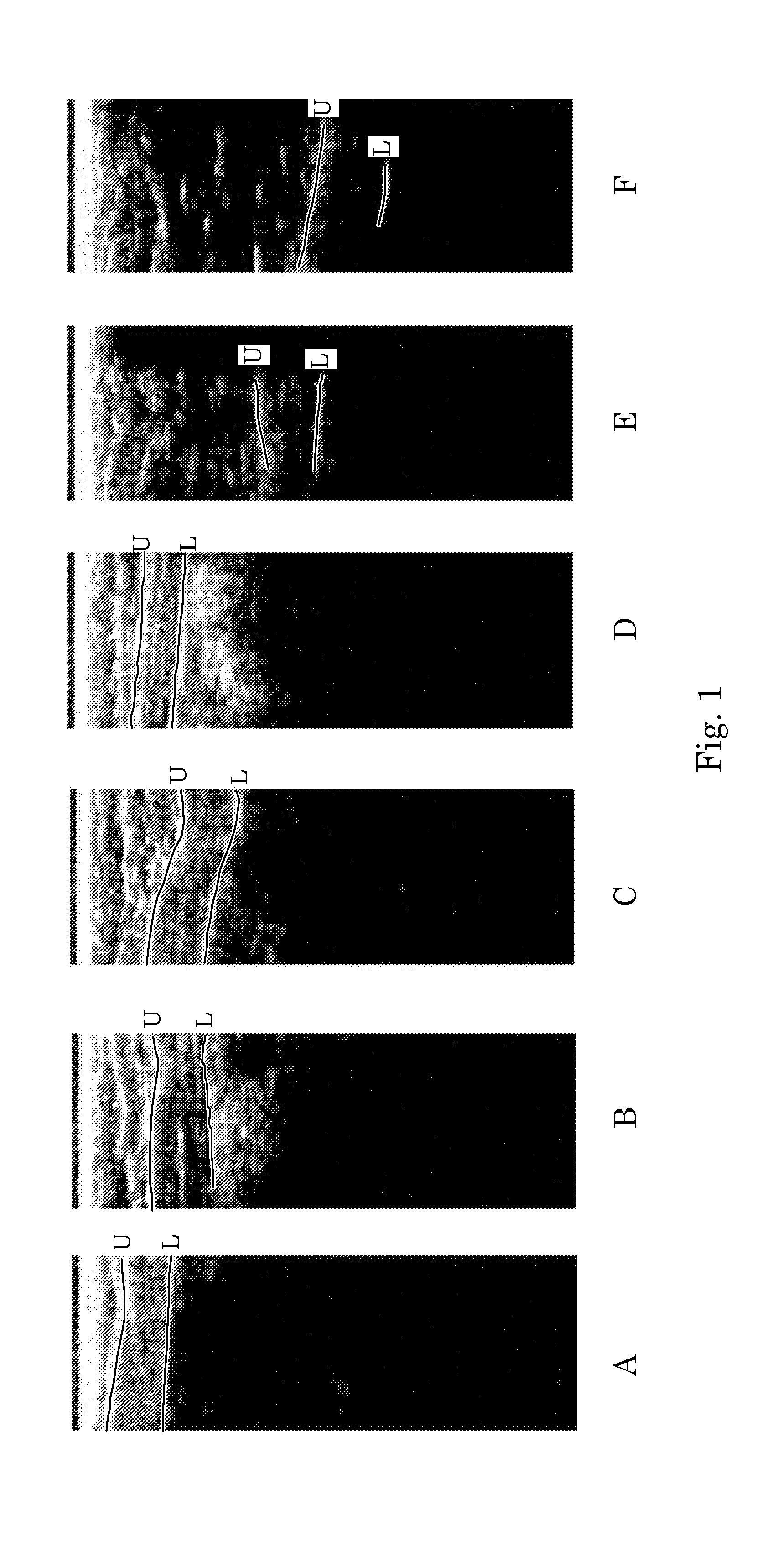 Orientation-Aware Average Intensity Histogram to Indicate Object Boundary Depth in Ultrasound Images