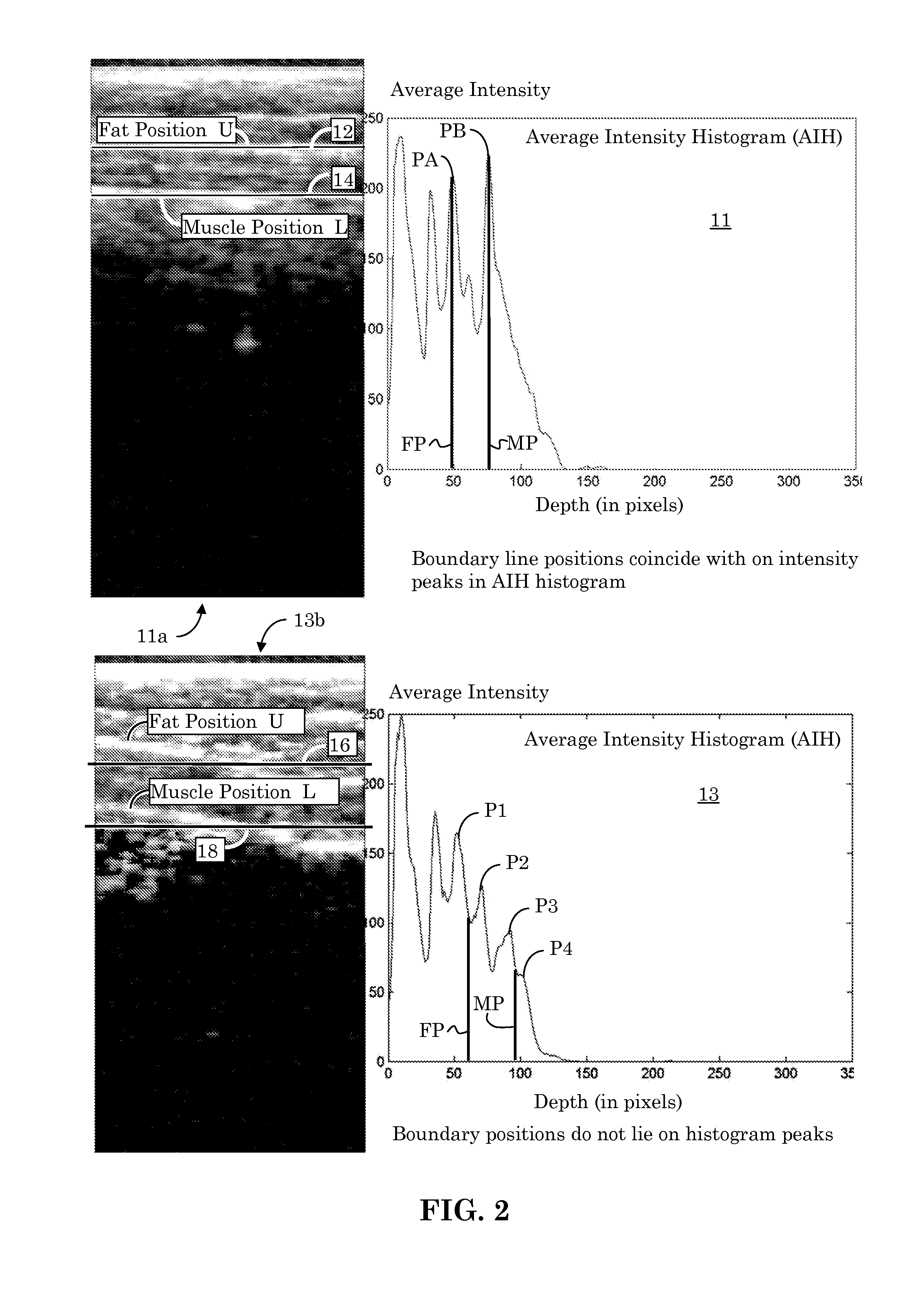 Orientation-Aware Average Intensity Histogram to Indicate Object Boundary Depth in Ultrasound Images