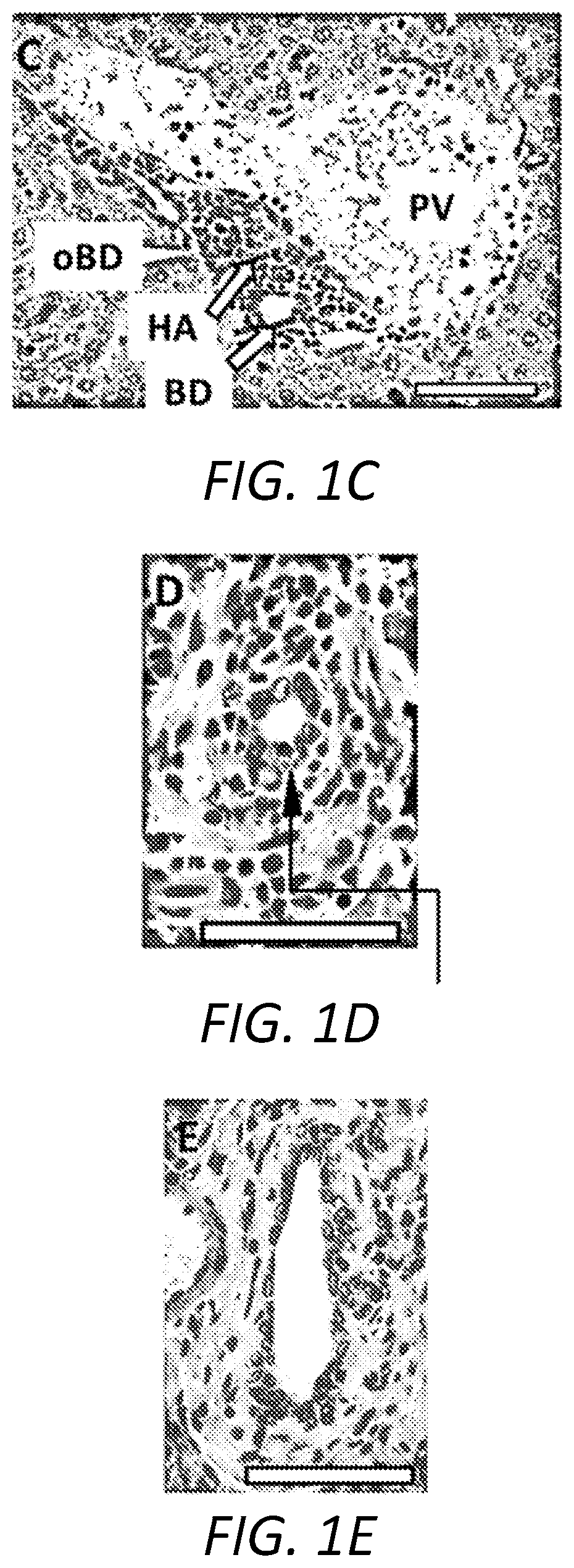 Method for treating primary sclerosing cholangitis