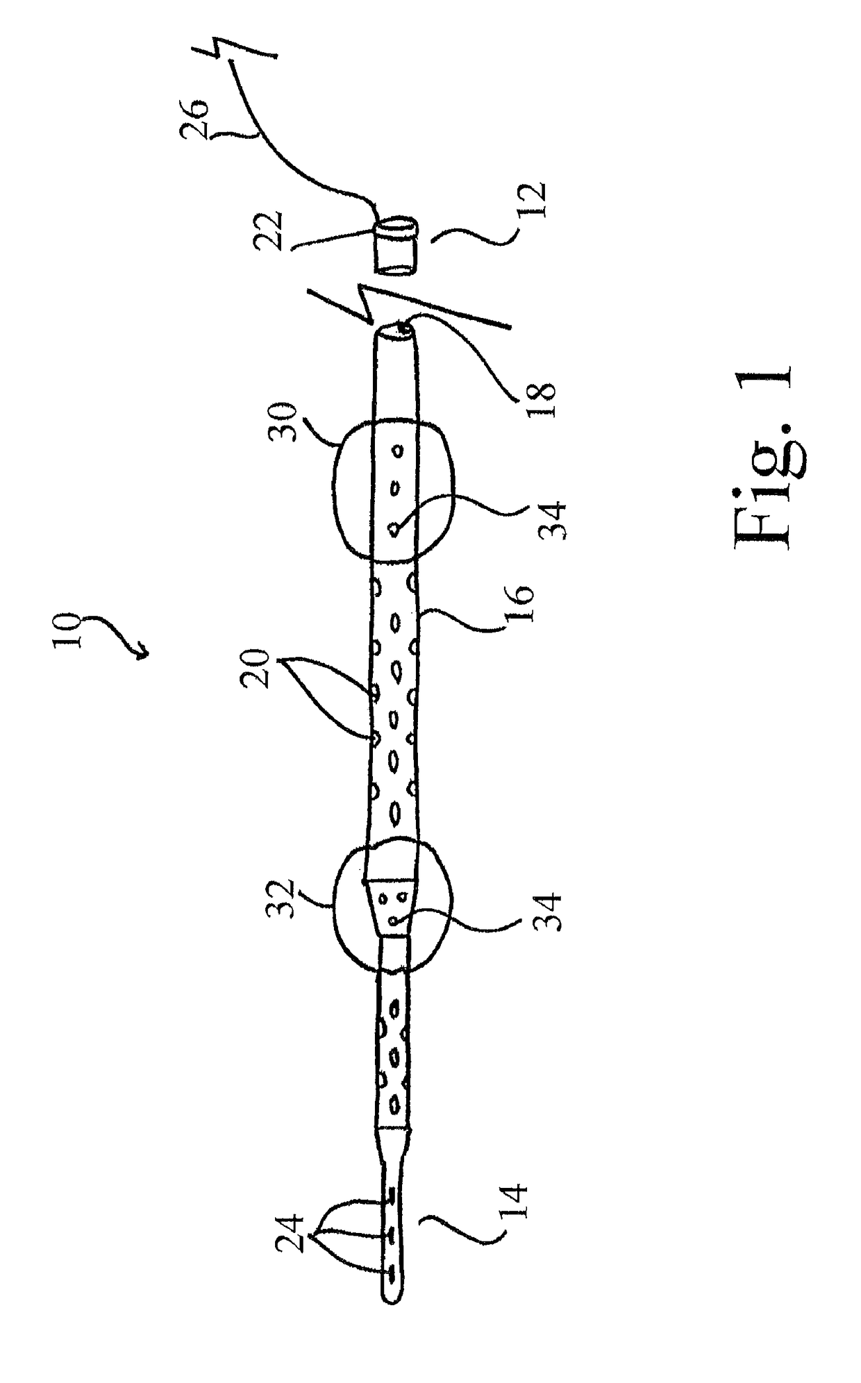 Systems and methods for selective auto-retroperfusion along with regional mild hypothermia