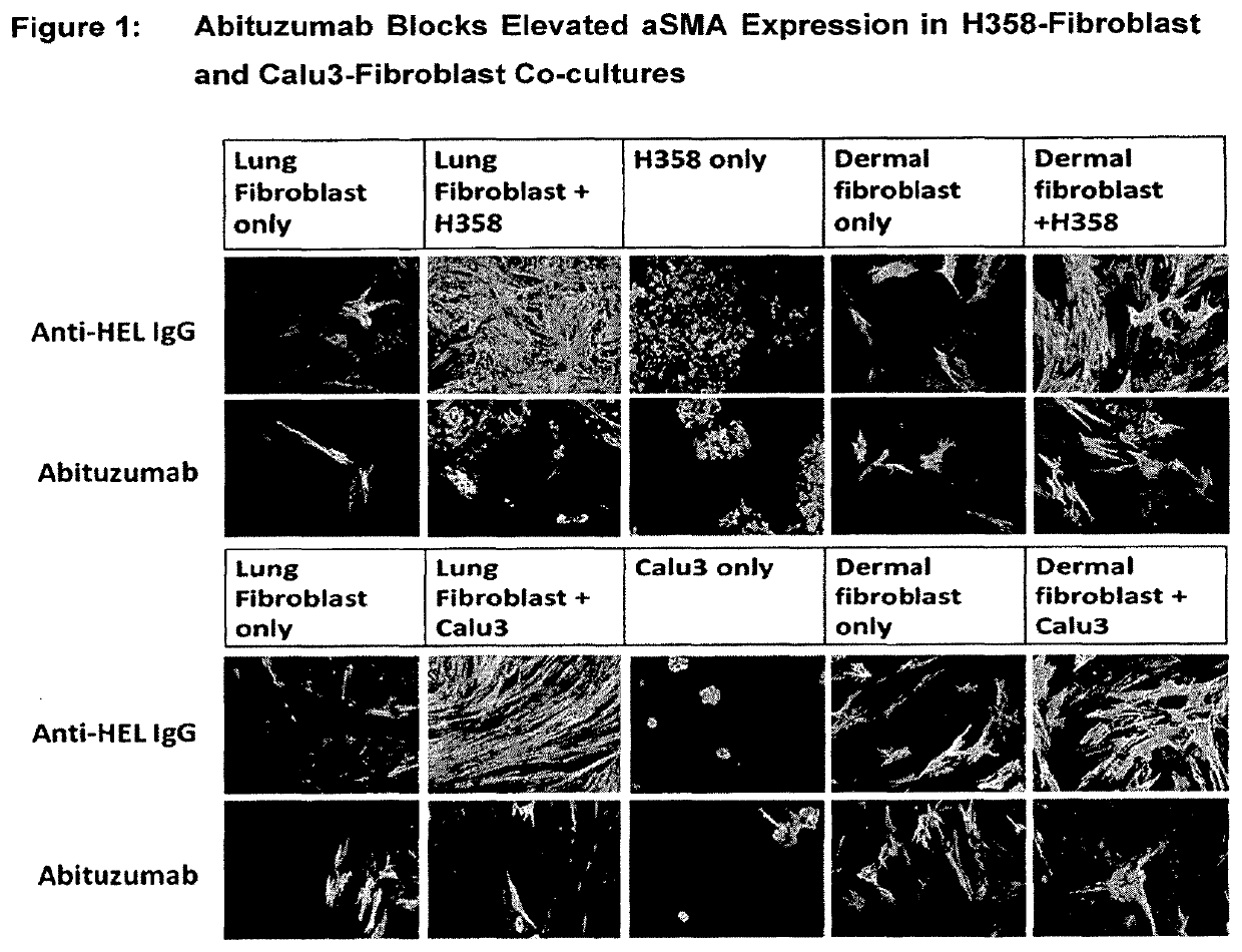 Anti-alpha-v integrin antibody for the treatment of fibrosis and/or fibrotic disorders