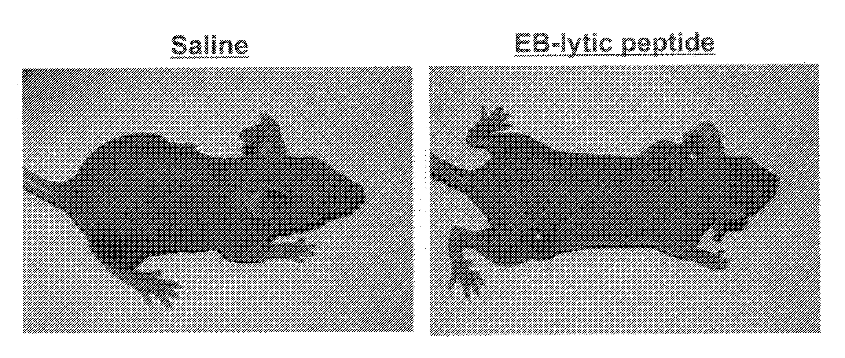 Selective anticancer chimeric peptide