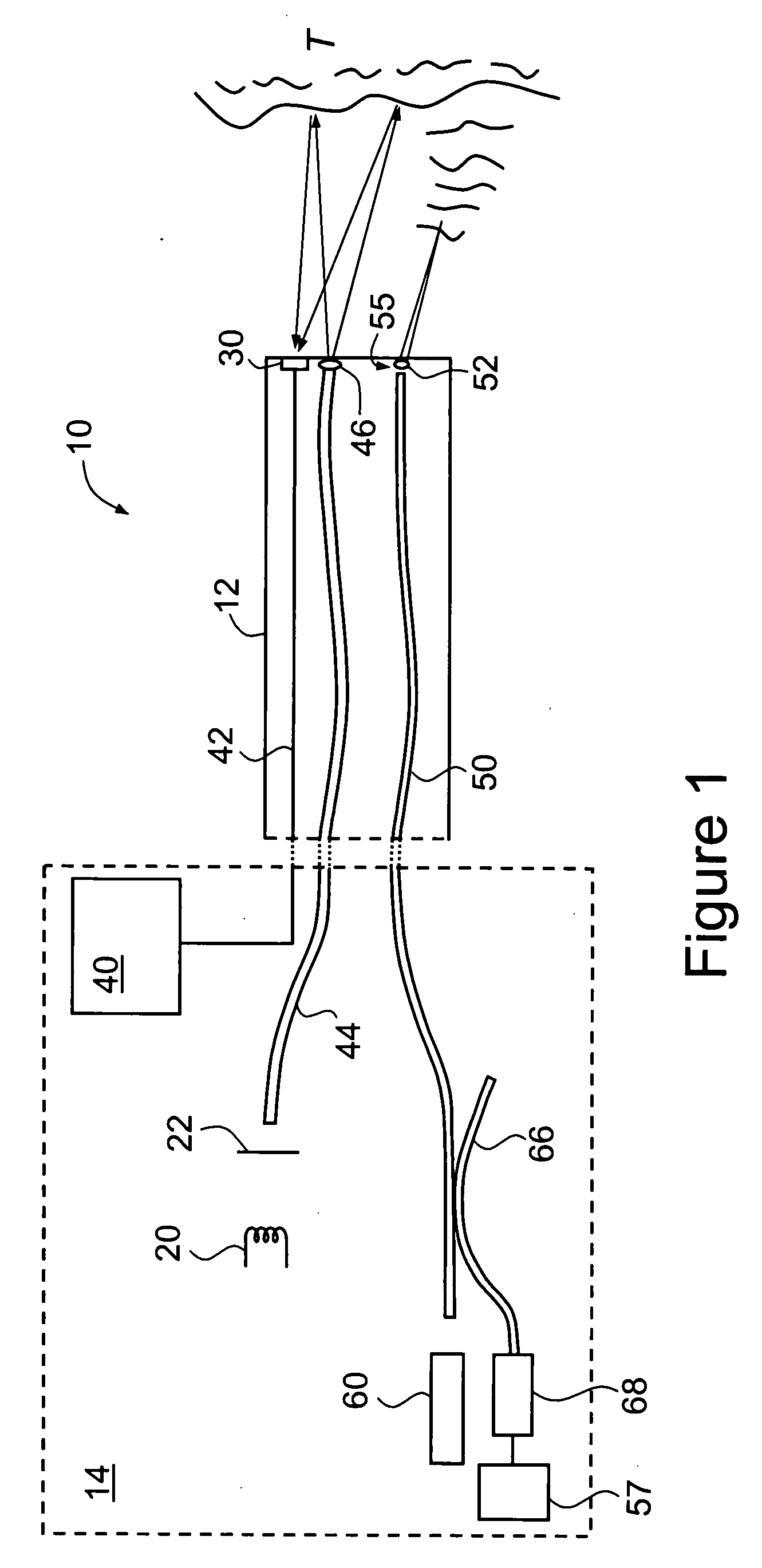 Endoscope