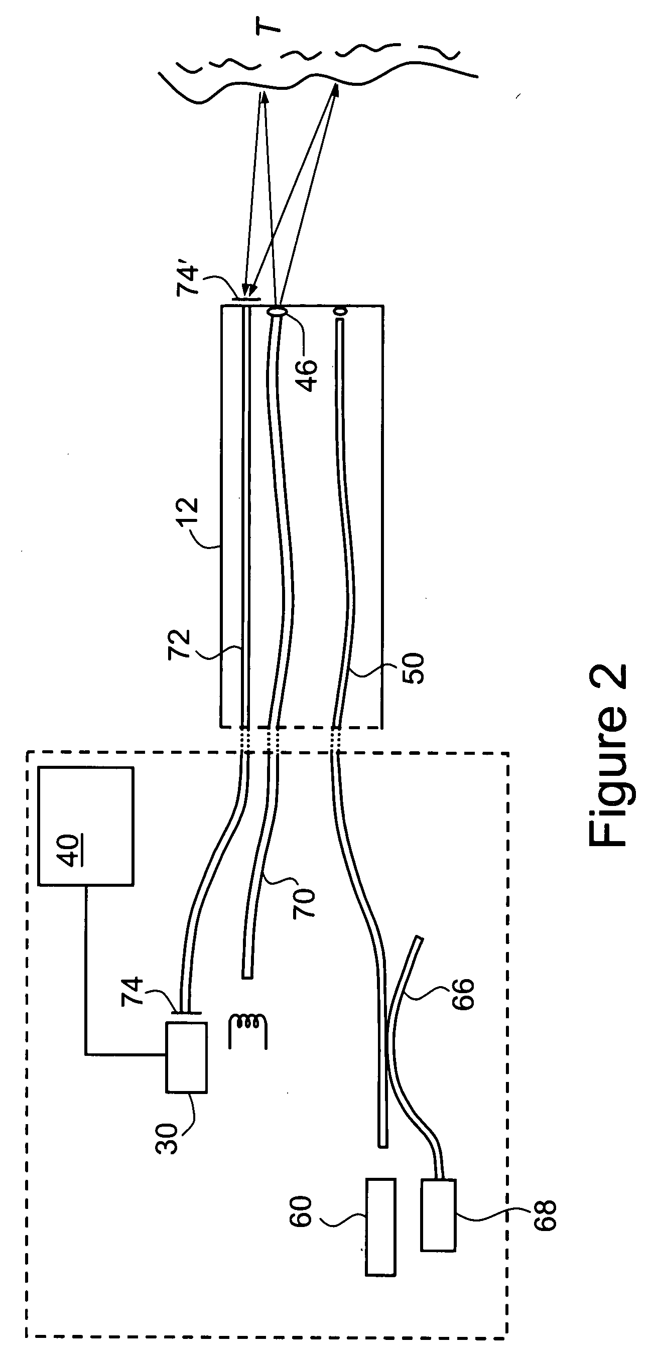 Endoscope