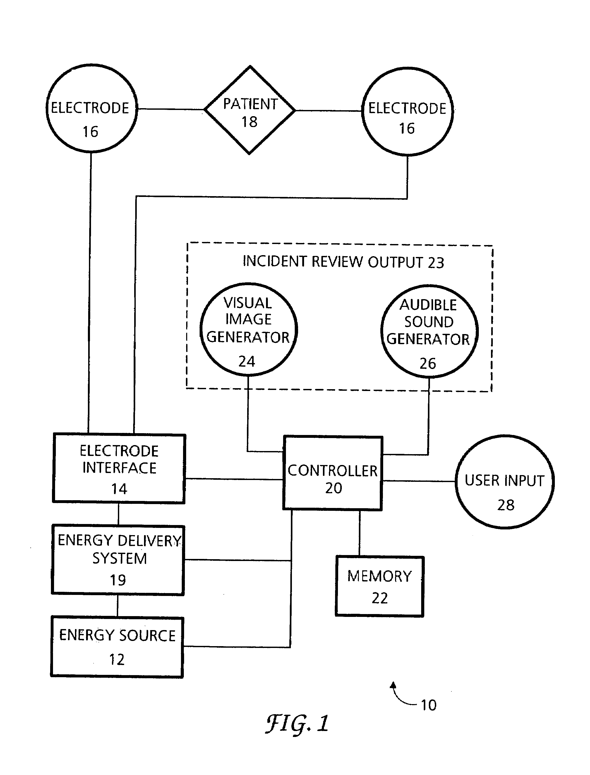 Method and apparatus for providing on-screen incident review in an AED