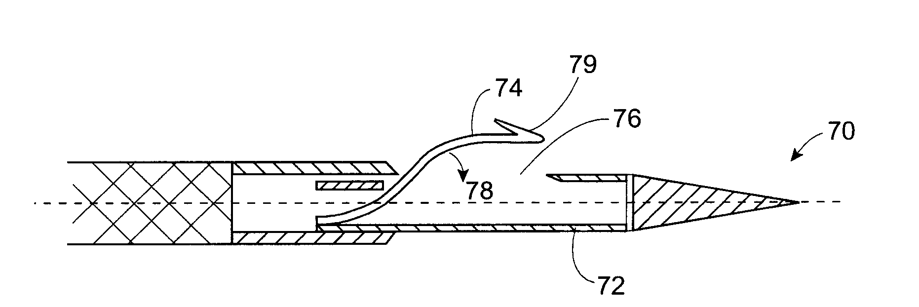 Apparatus and methods for material capture and removal