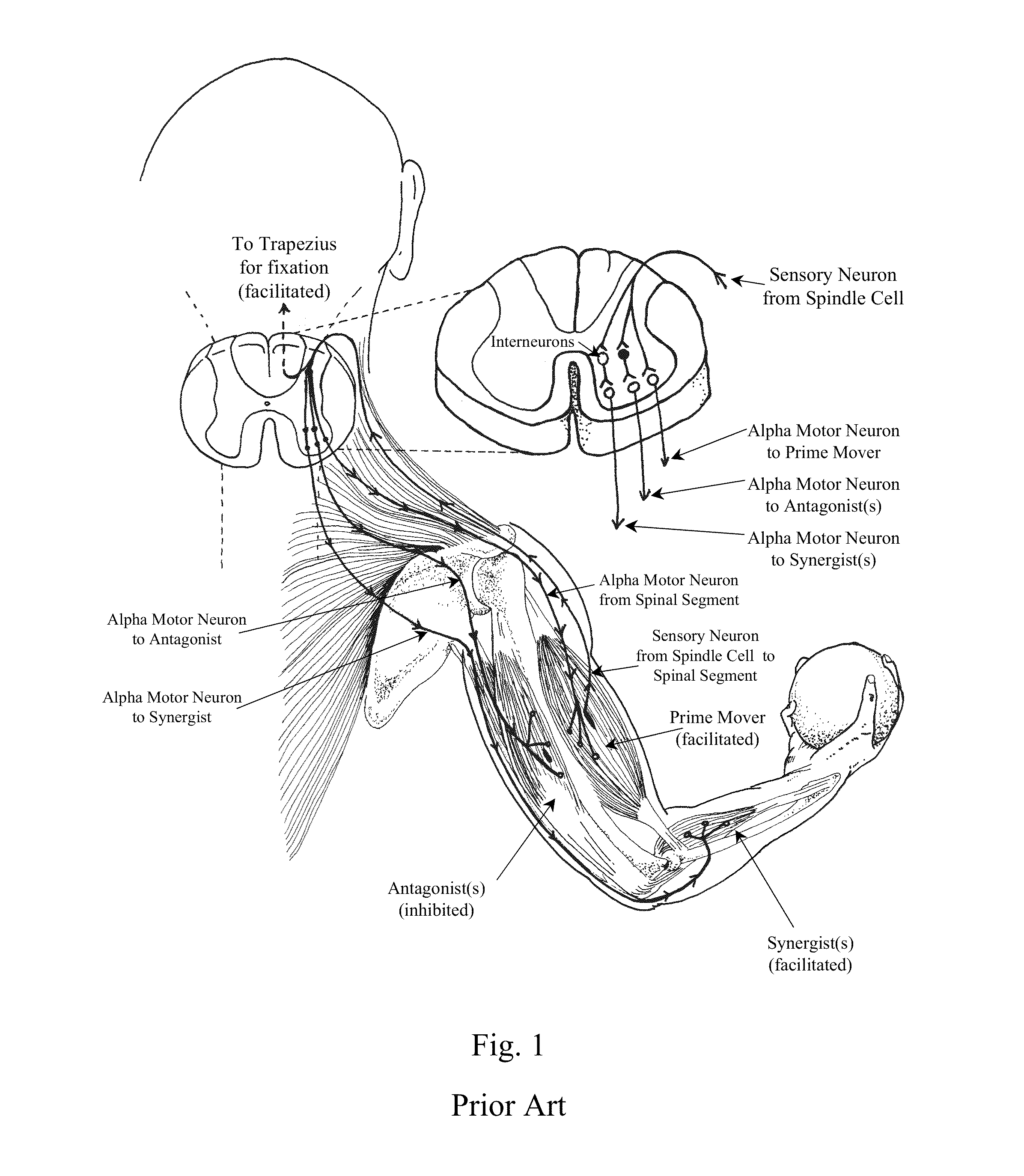 Muscle optimization device and method