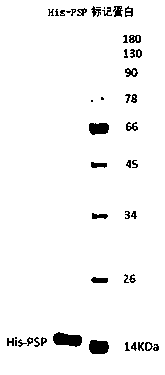 Method for preparing pancreatic stone protein antibody and method for detecting PSP (pancreatic stone protein)