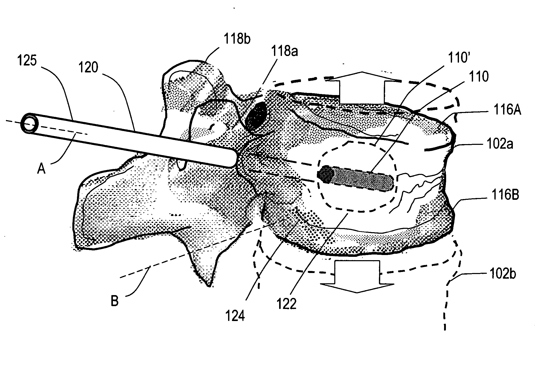 Biomedical treatment systems and methods