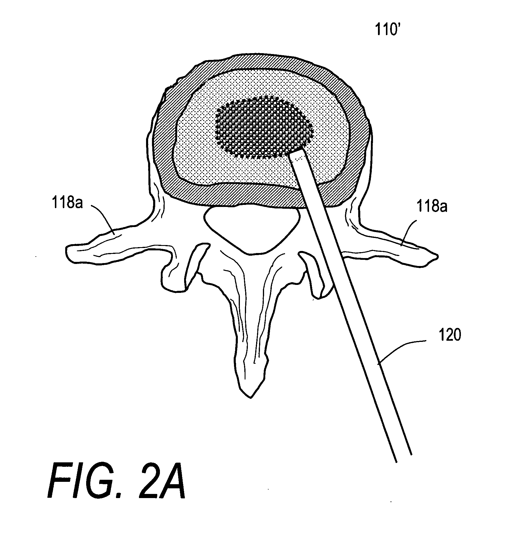 Biomedical treatment systems and methods