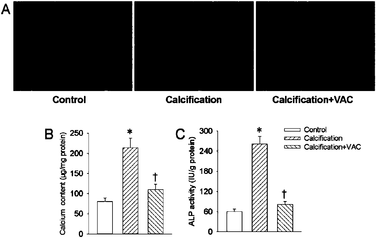 Application of vaccarin in preparation of drug for preventing angiosteosis