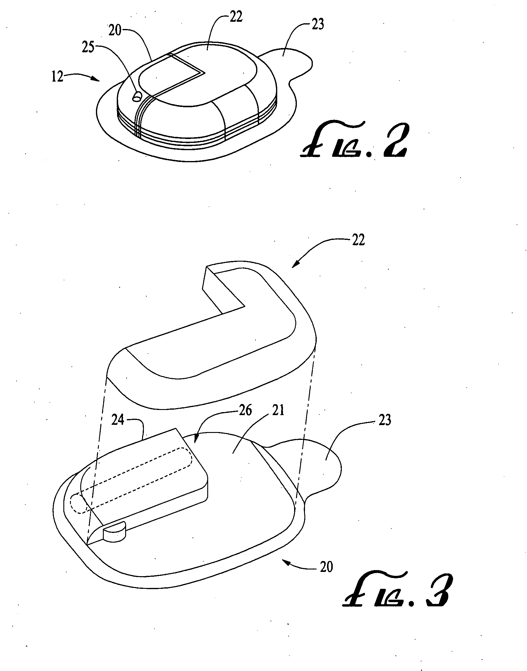 Infusion medium delivery system, device and method with needle inserter and needle inserter device and method