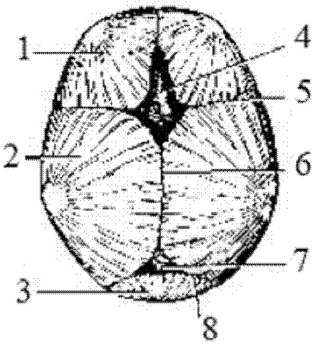 Skull guiding formwork for calvarium reconstruction surgery and manufacturing method of skull guiding formwork