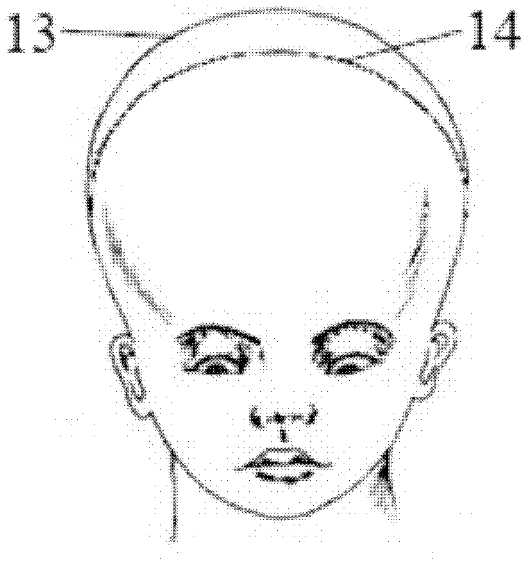 Skull guiding formwork for calvarium reconstruction surgery and manufacturing method of skull guiding formwork