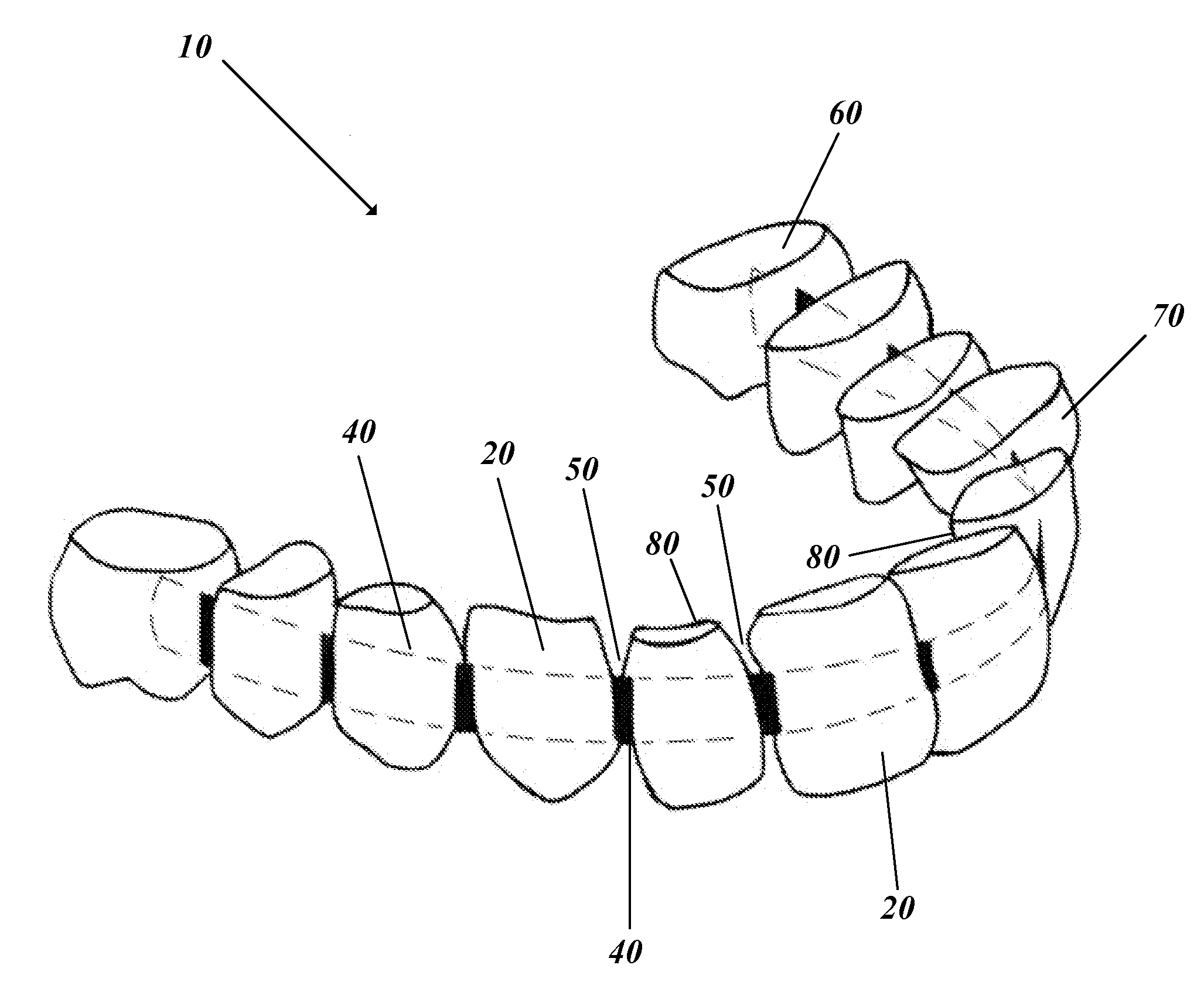 Teeth indexing device