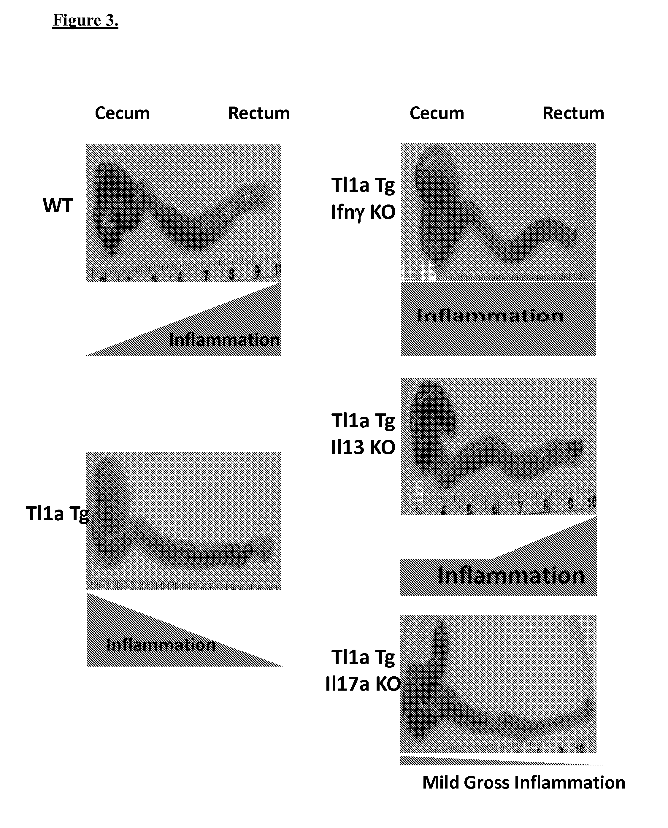 Distinct effects of ifn-gamma and il-17 on tl1a modulated inflammation and fibrosis