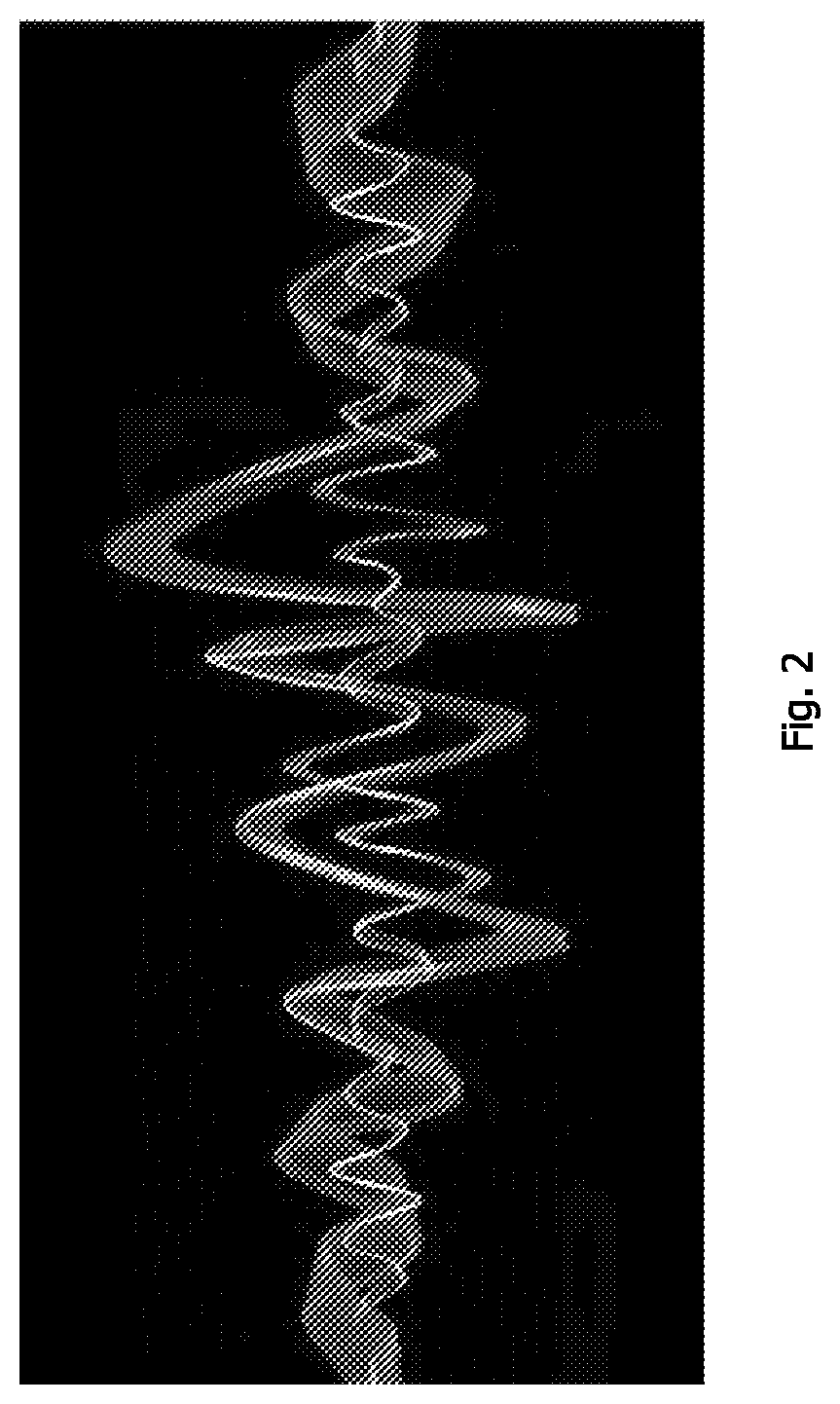 Method and apparatus for improvement of microcirculation