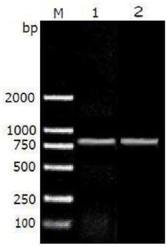 Specific primer for novel coronary virus detection and rapid detection method