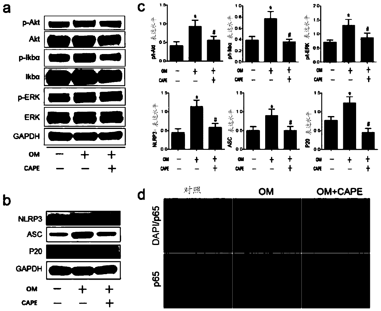 Application of caffeic acid phenethyl ester in treatment of CAVD