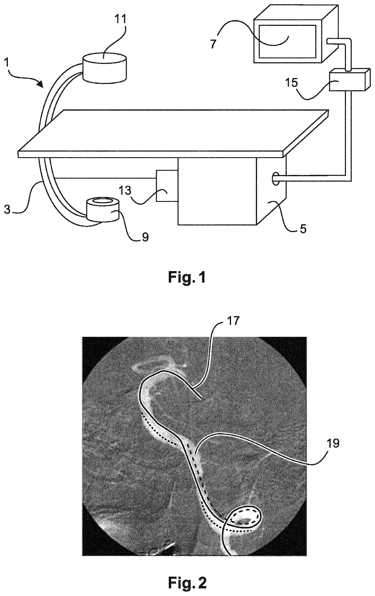 Automatic device-footprint-free roadmapping for endovascular interventions