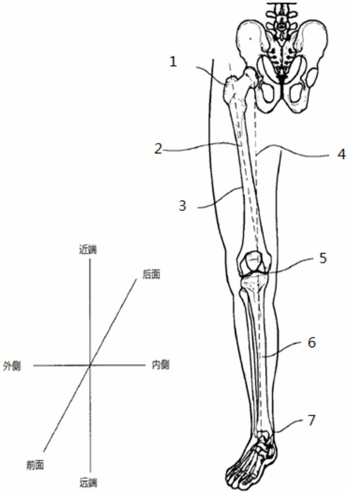 Auxiliary positioning method and system for joint replacement surgery based on inertial navigation