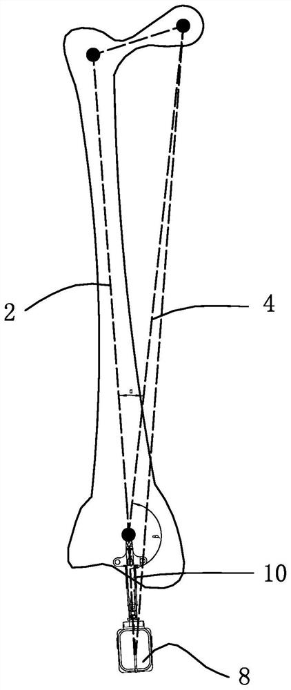 Auxiliary positioning method and system for joint replacement surgery based on inertial navigation