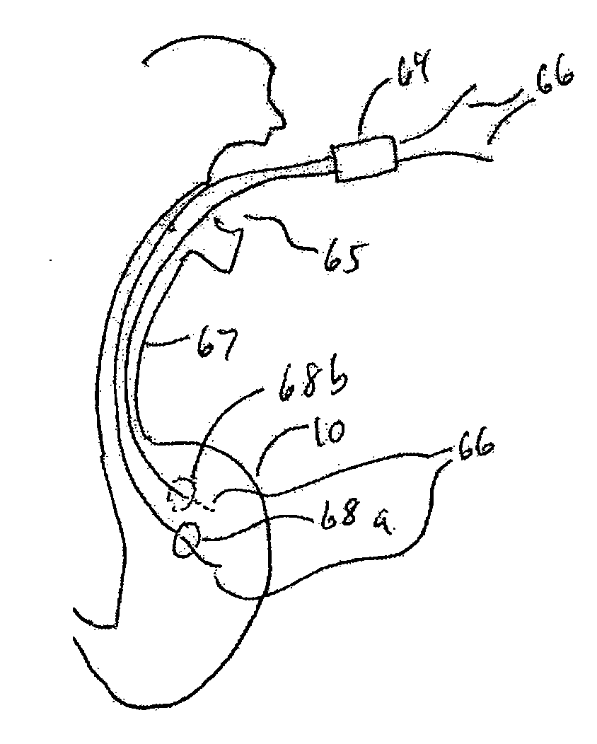 Methods and Devices for Organ Partitioning