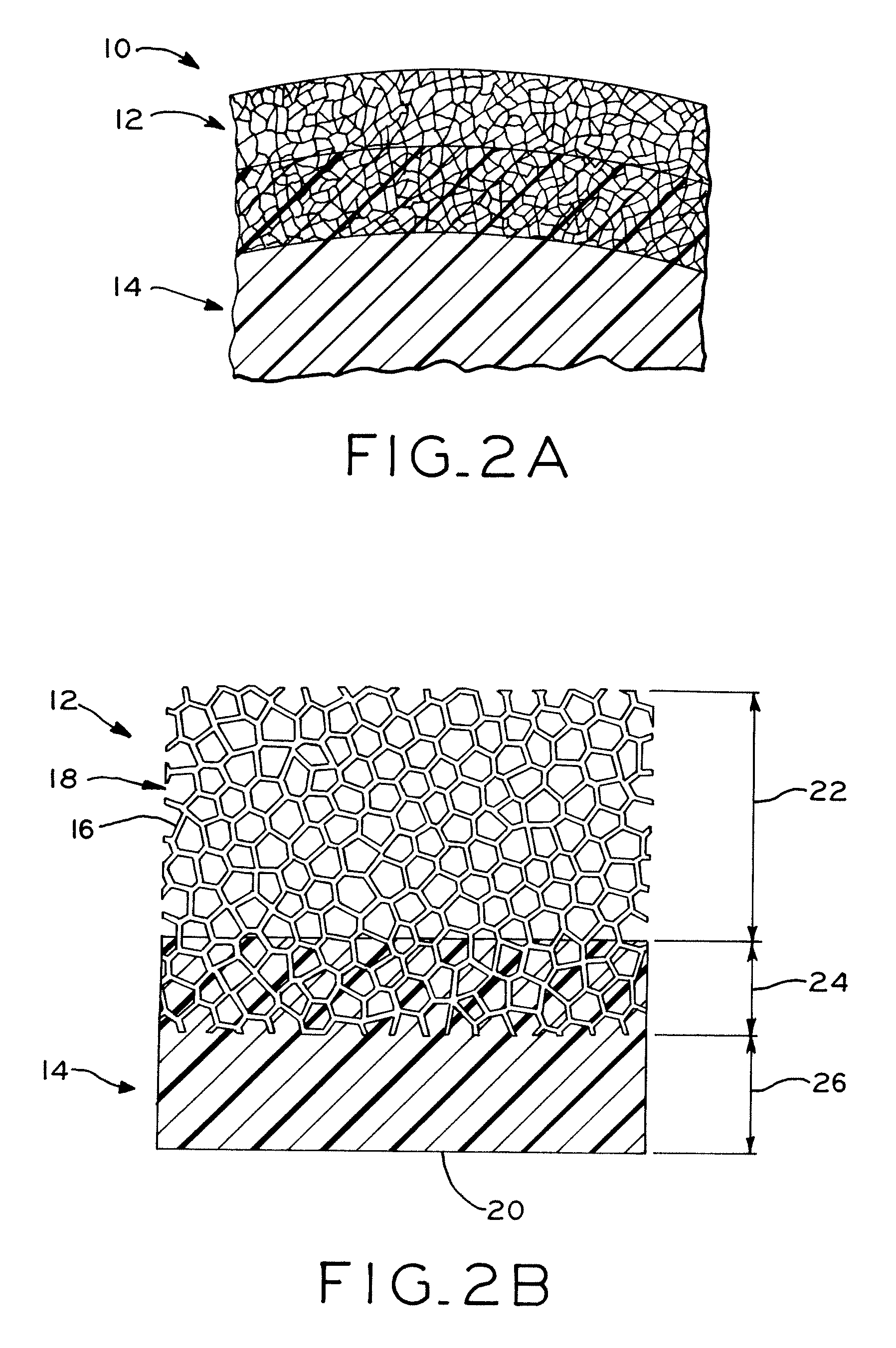 Orthopedic component of low stiffness