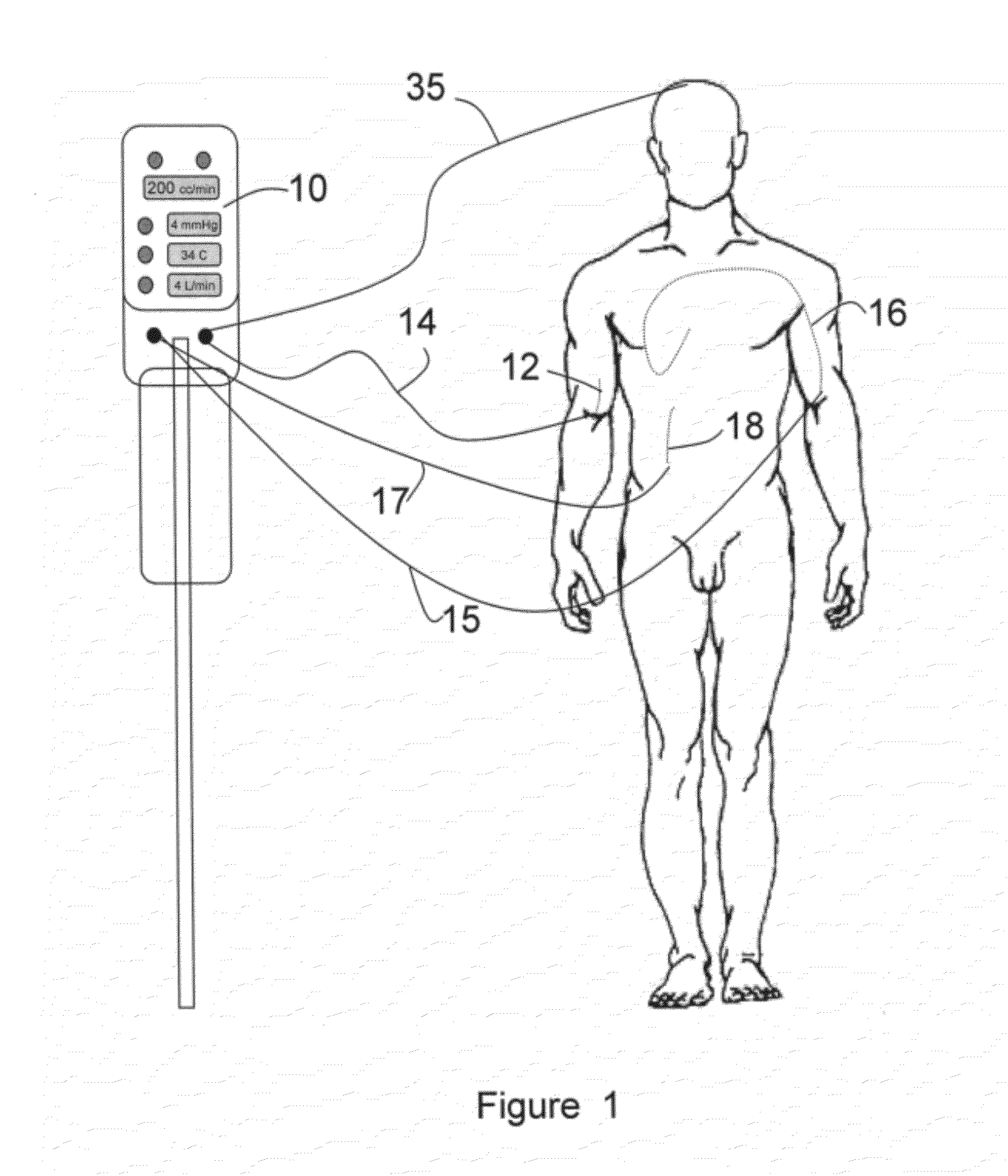 Automated Therapy System and Method