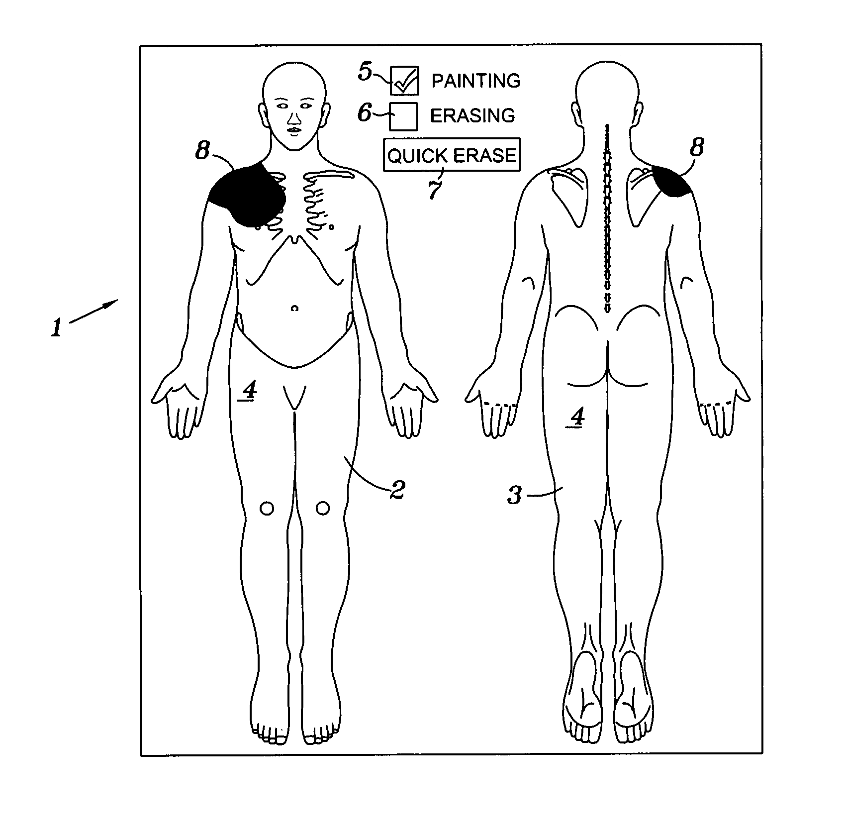 Computer pain assessment tool