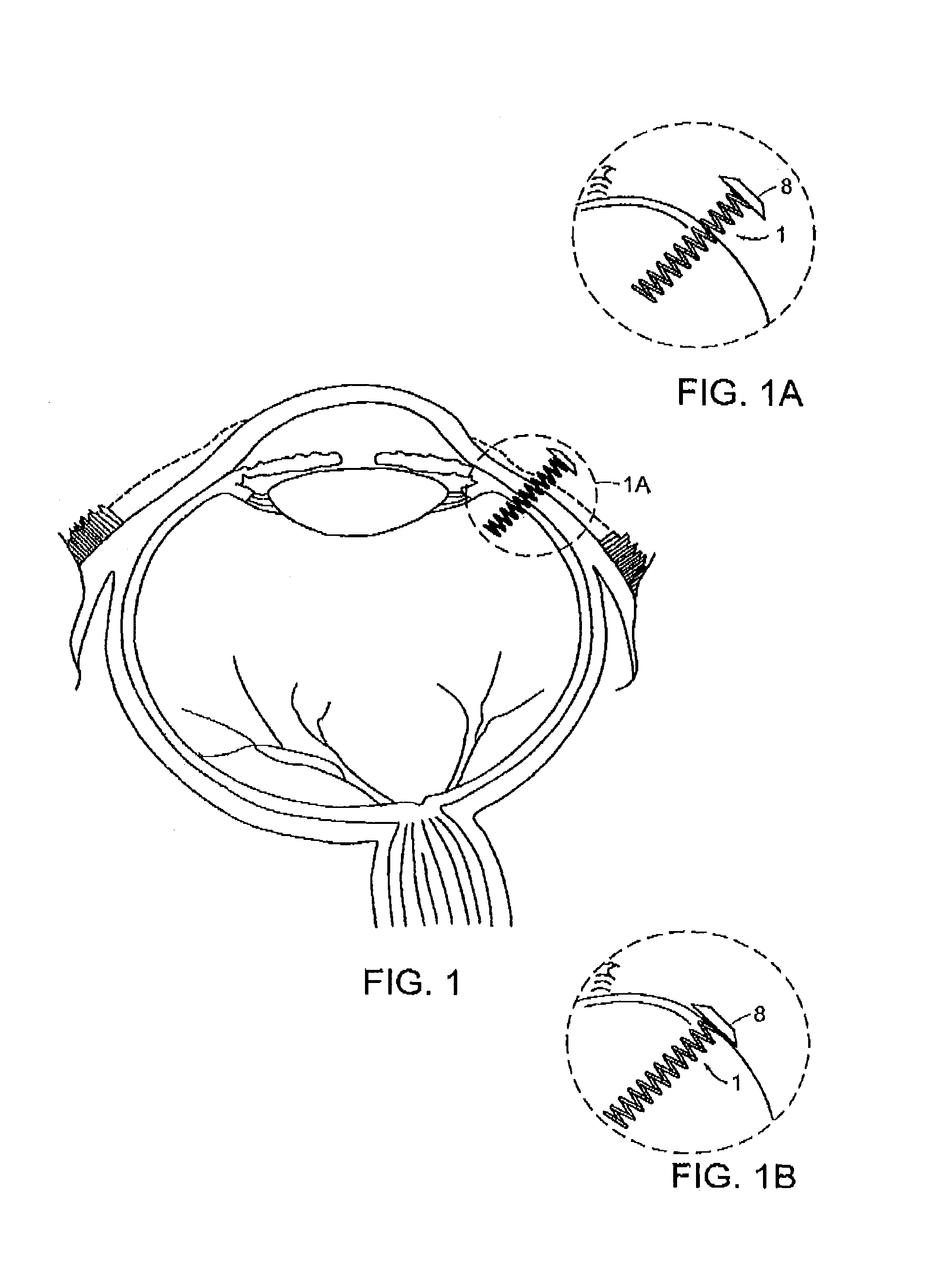 Devices for intraocular drug delivery