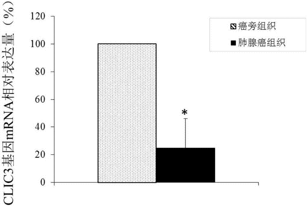 Application of CLIC3 as lung adenocarcinoma diagnosis and treatment target