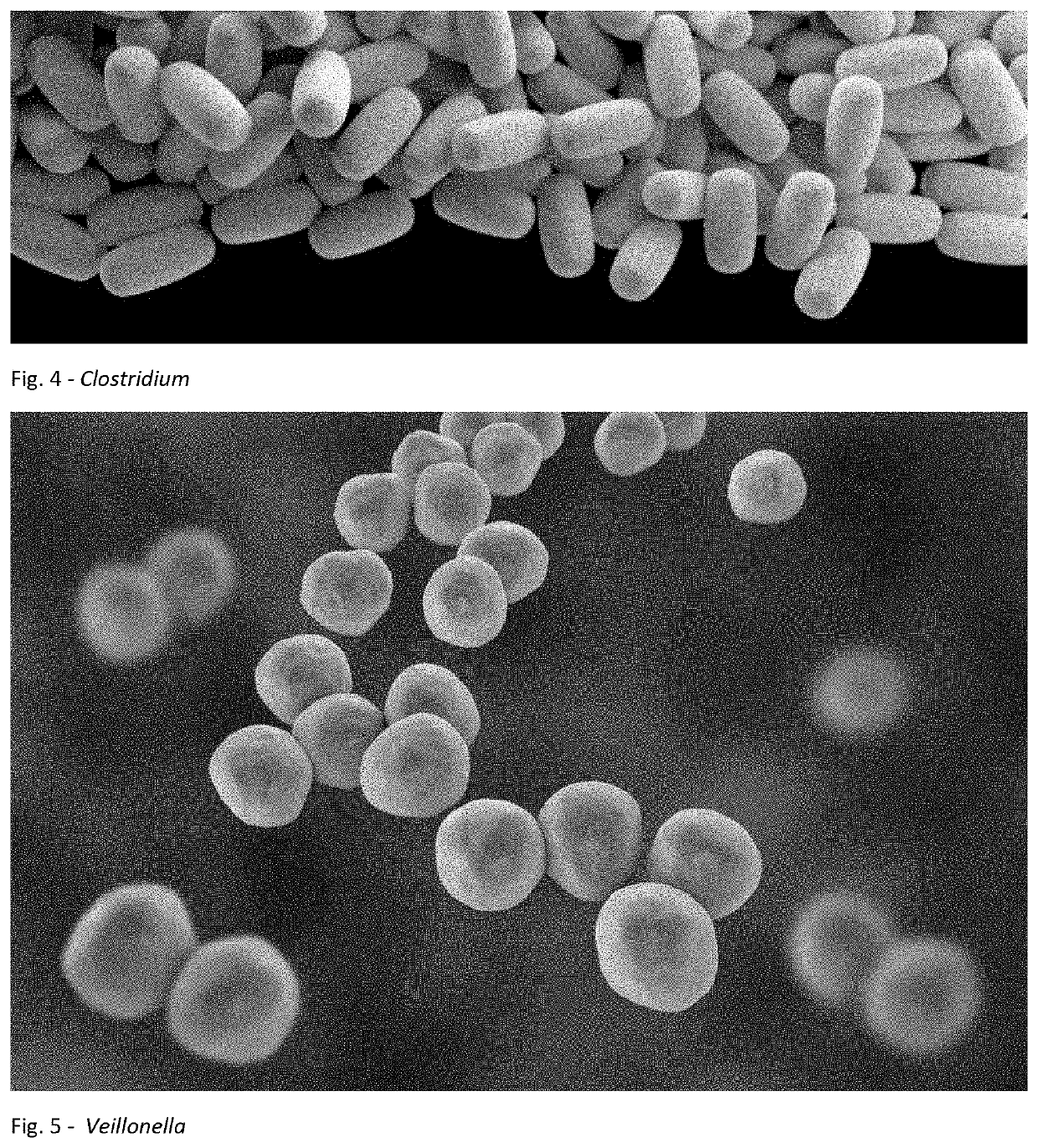 Method for Treating an Individual Suffering from a Chronic Infectious Disease and Cancer