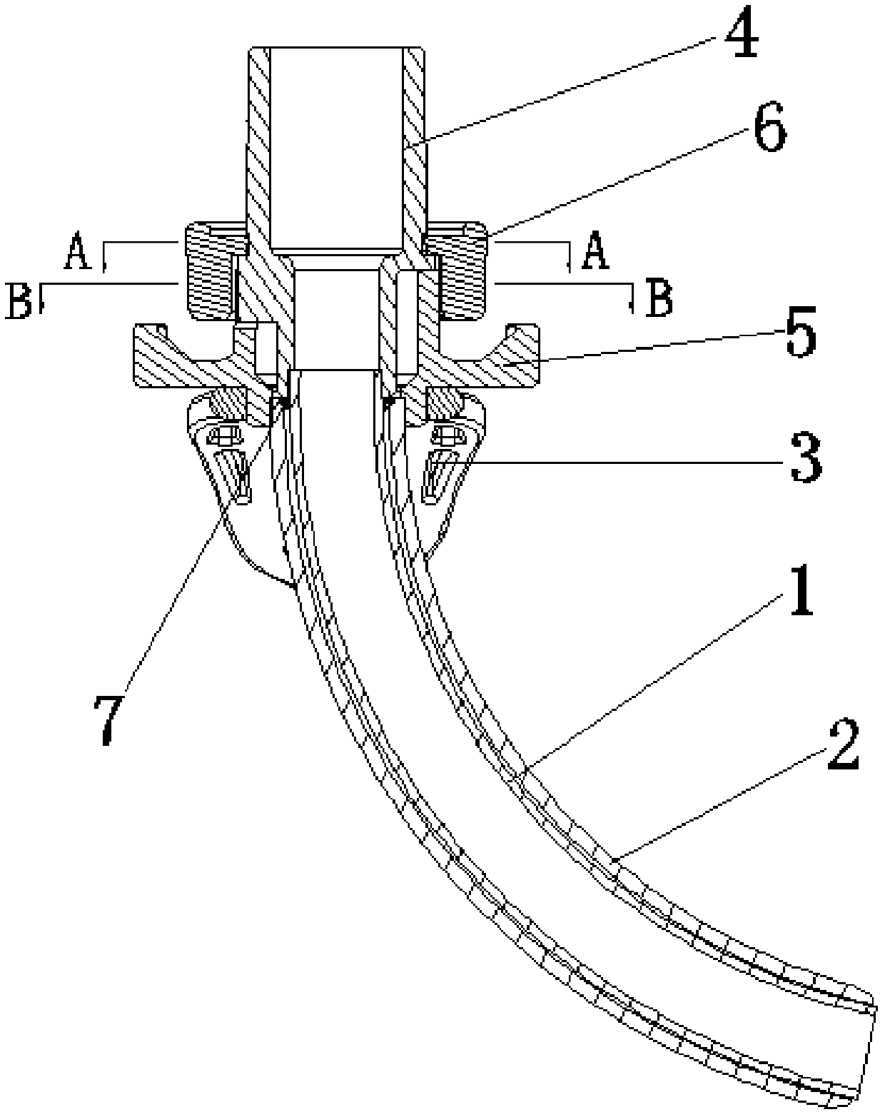 Tracheostomy tube