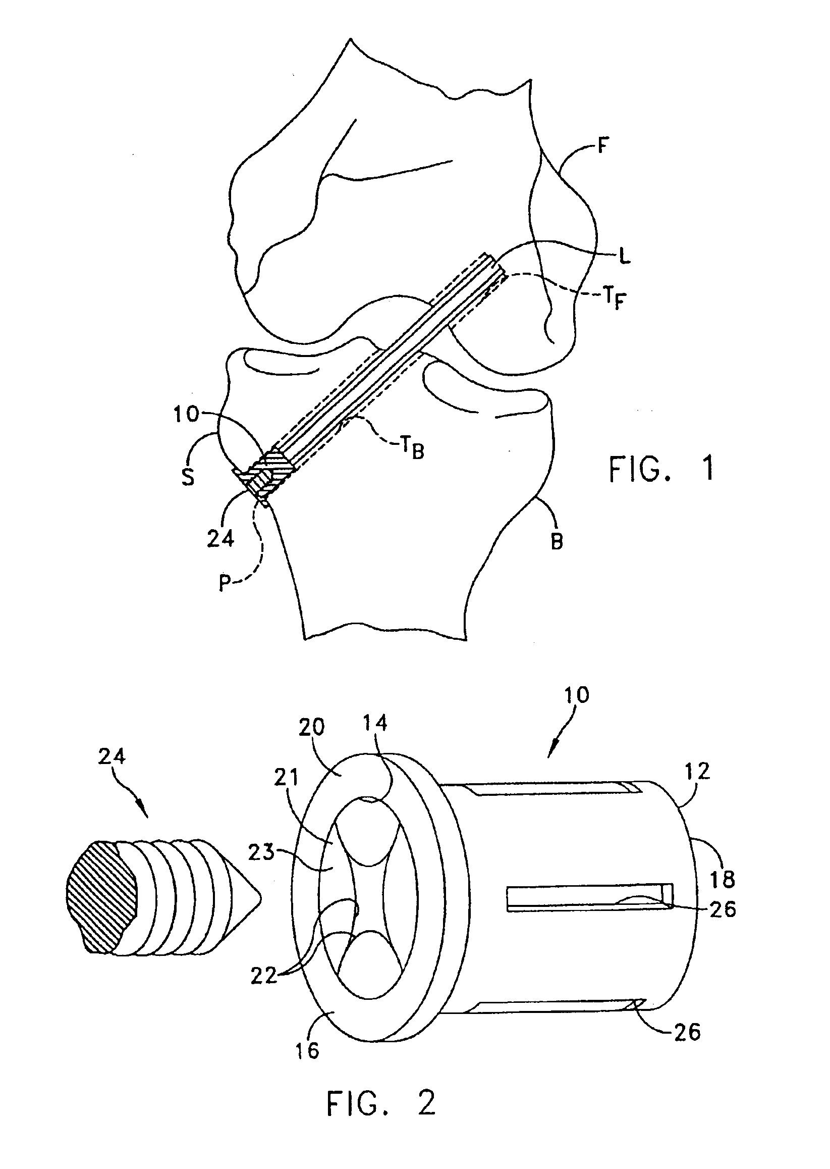 Graft ligament anchor and method for attaching a graft ligament to a bone