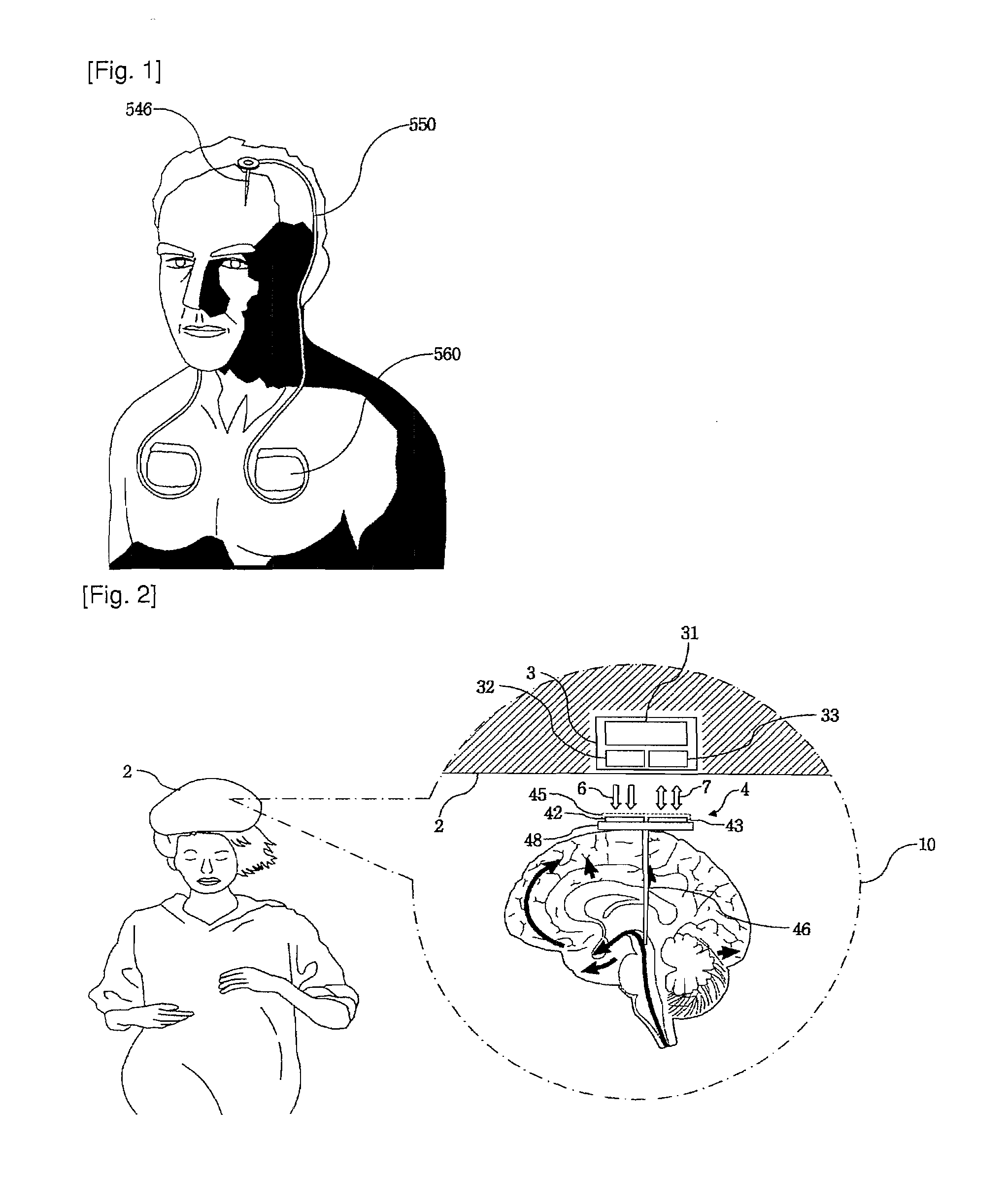 Neural Electronic Interface Device For Motor And Sensory Controls of Human Body