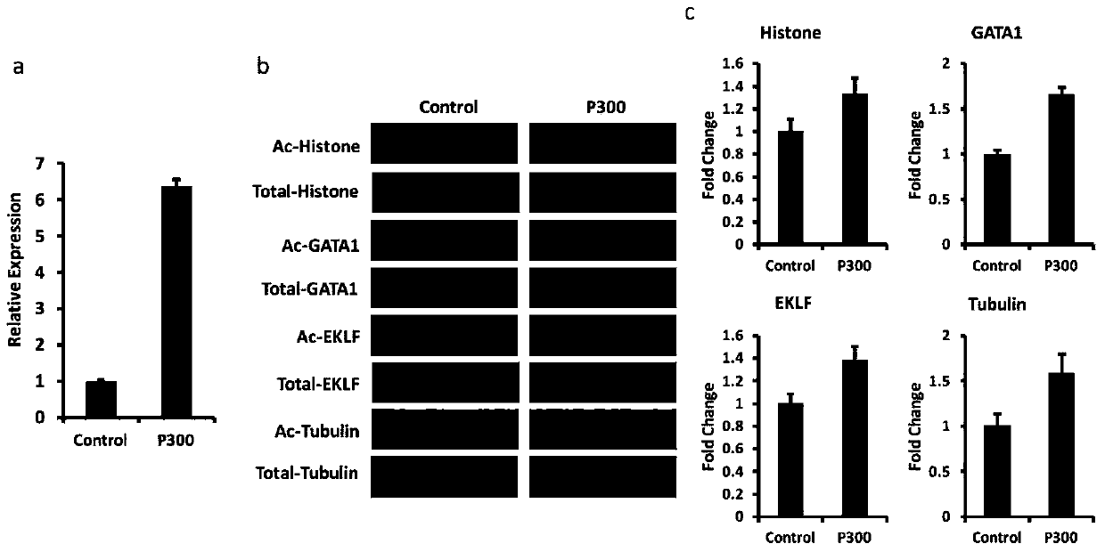 Protein chip and kit for detecting protein acetylation level