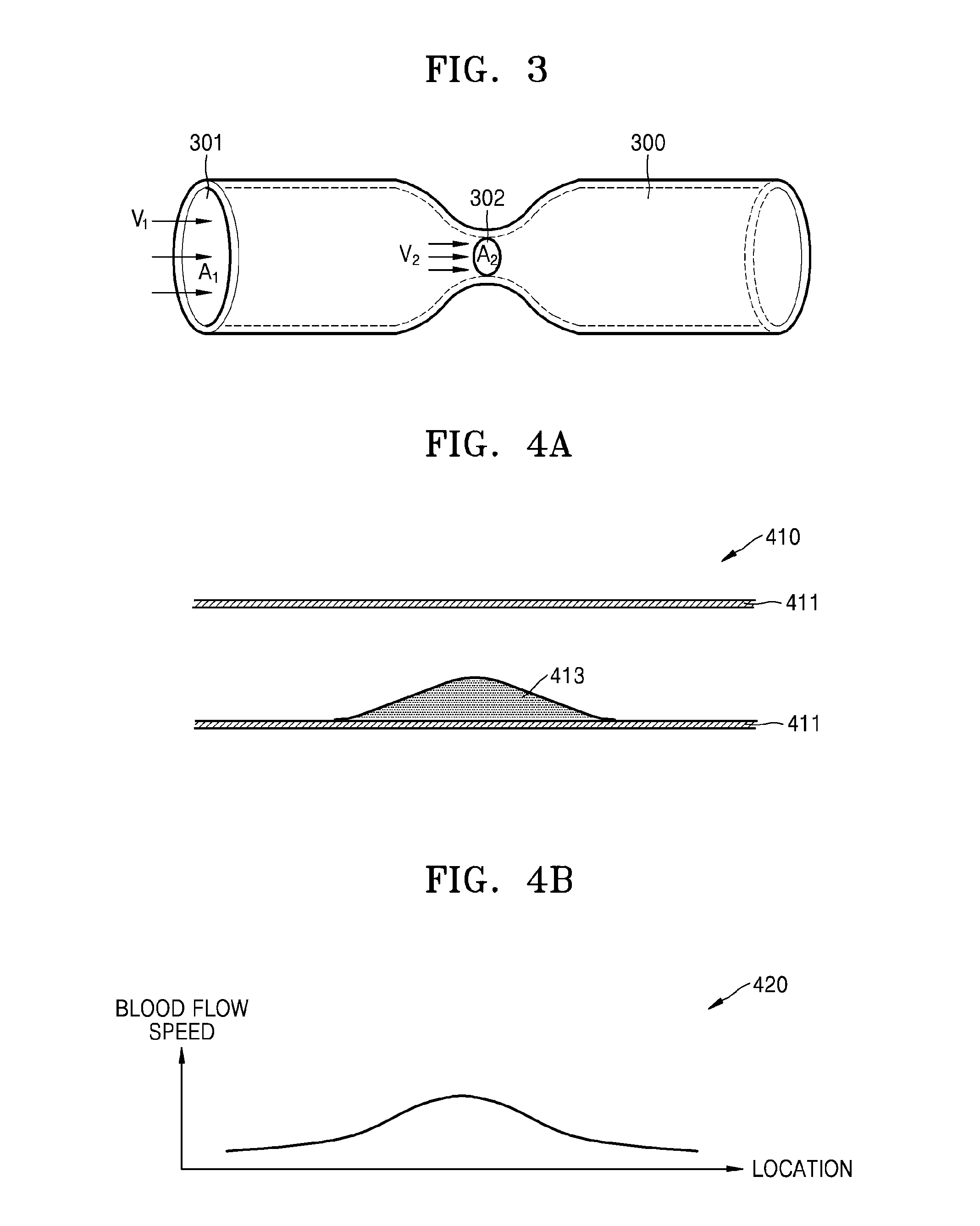 Apparatus and method for displaying ultrasound image