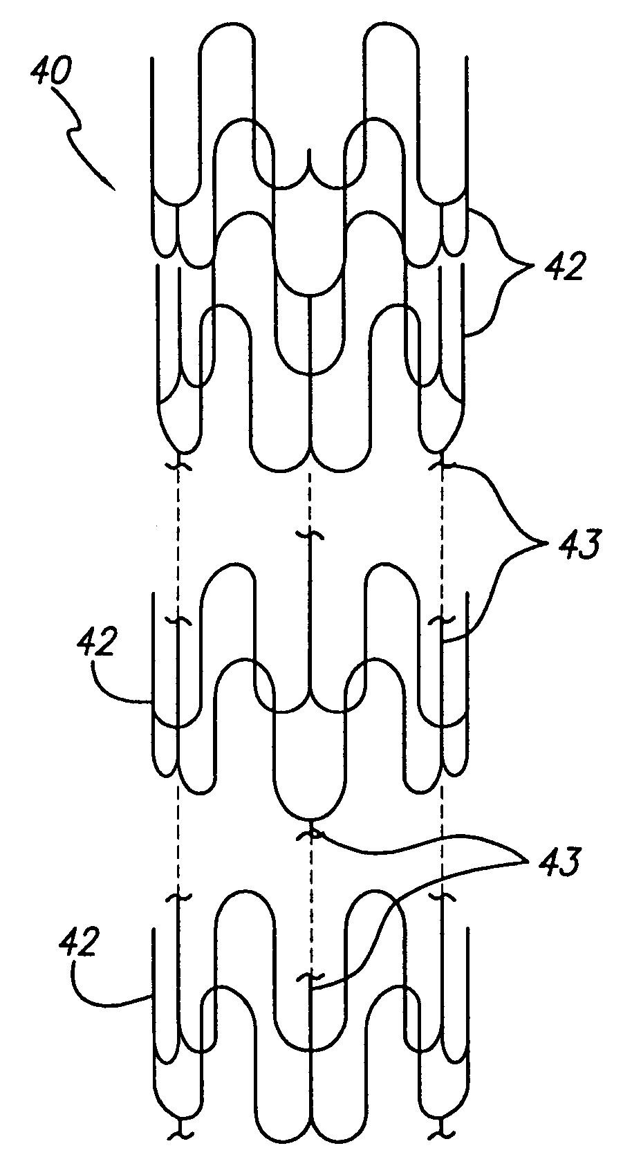 Multilayer stent