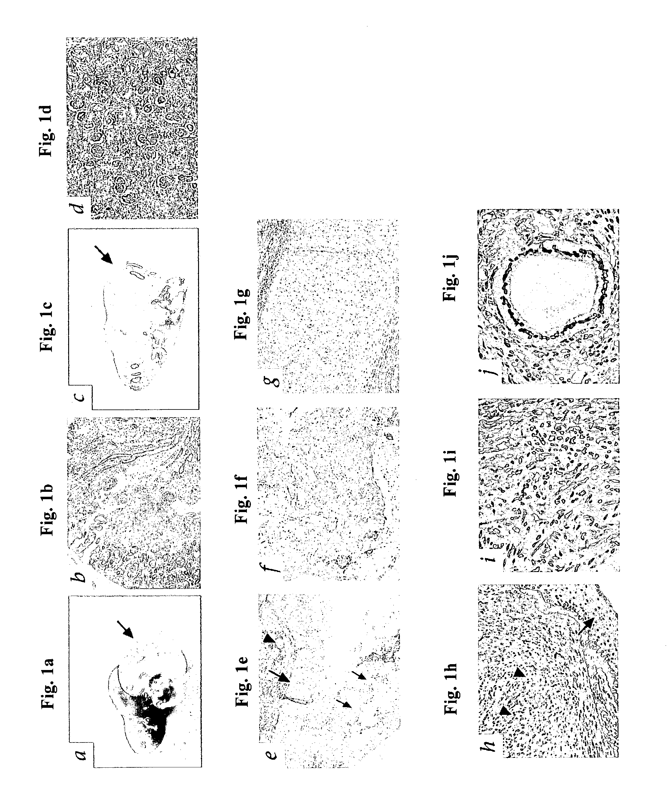 Methods of treating disease by transplantation of developing allogeneic or xenogeneic organs or tissues