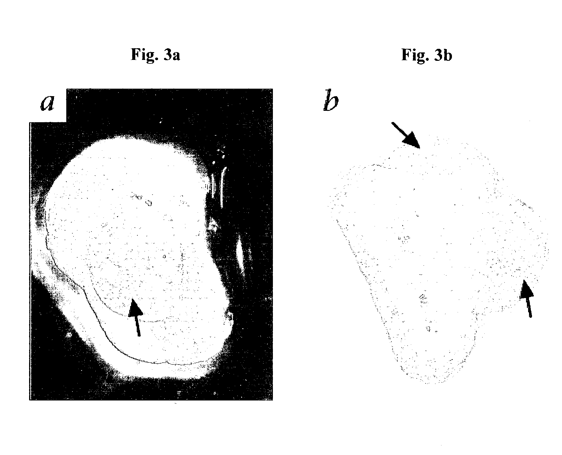 Methods of treating disease by transplantation of developing allogeneic or xenogeneic organs or tissues