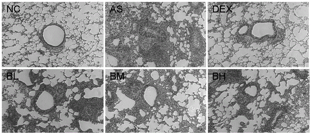 Application of baohuoside I in preparation of drugs for treating asthma